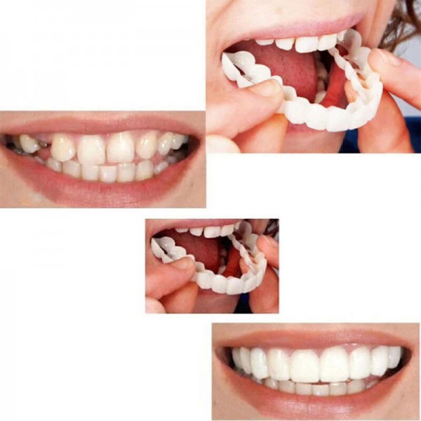 Kosmetische Zahnmedizin Prothese Zahnersatz für Falsche Zähne Lücken verbergen